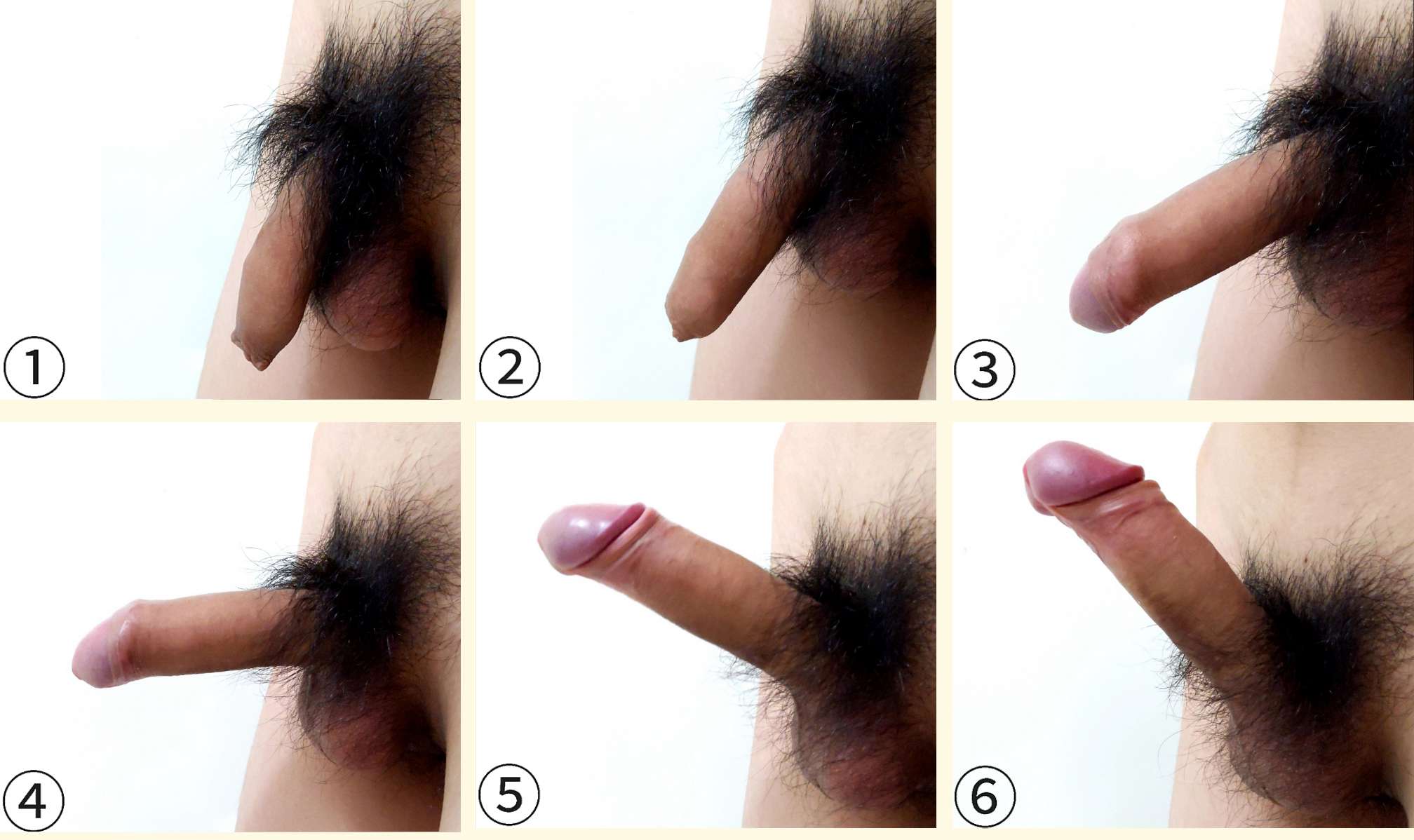 图 11，男性的性兴奋，阴茎变大并变硬。